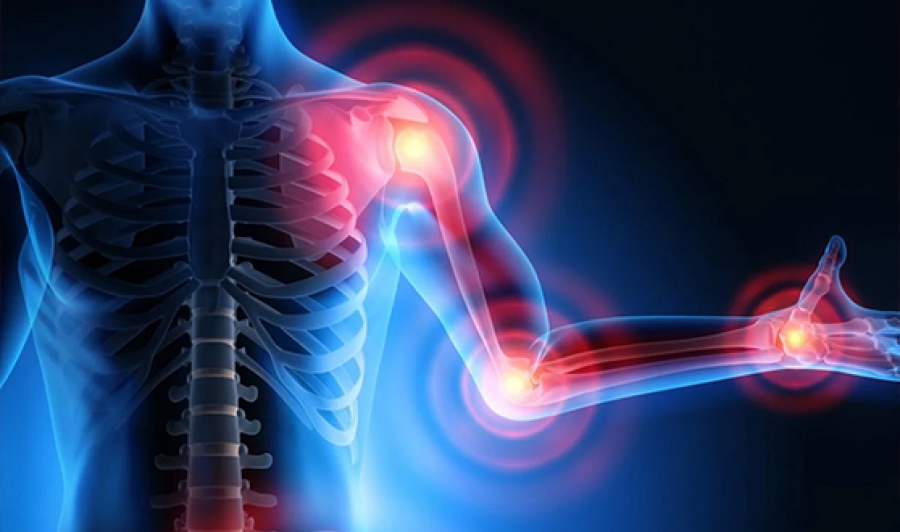 Tratamento de quimioterapia na Plena Saúde em Porto Velho